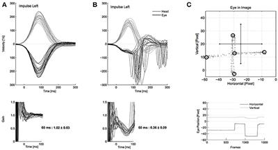 Usability of the Video Head Impulse Test: Lessons From the Population-Based Prospective KORA Study